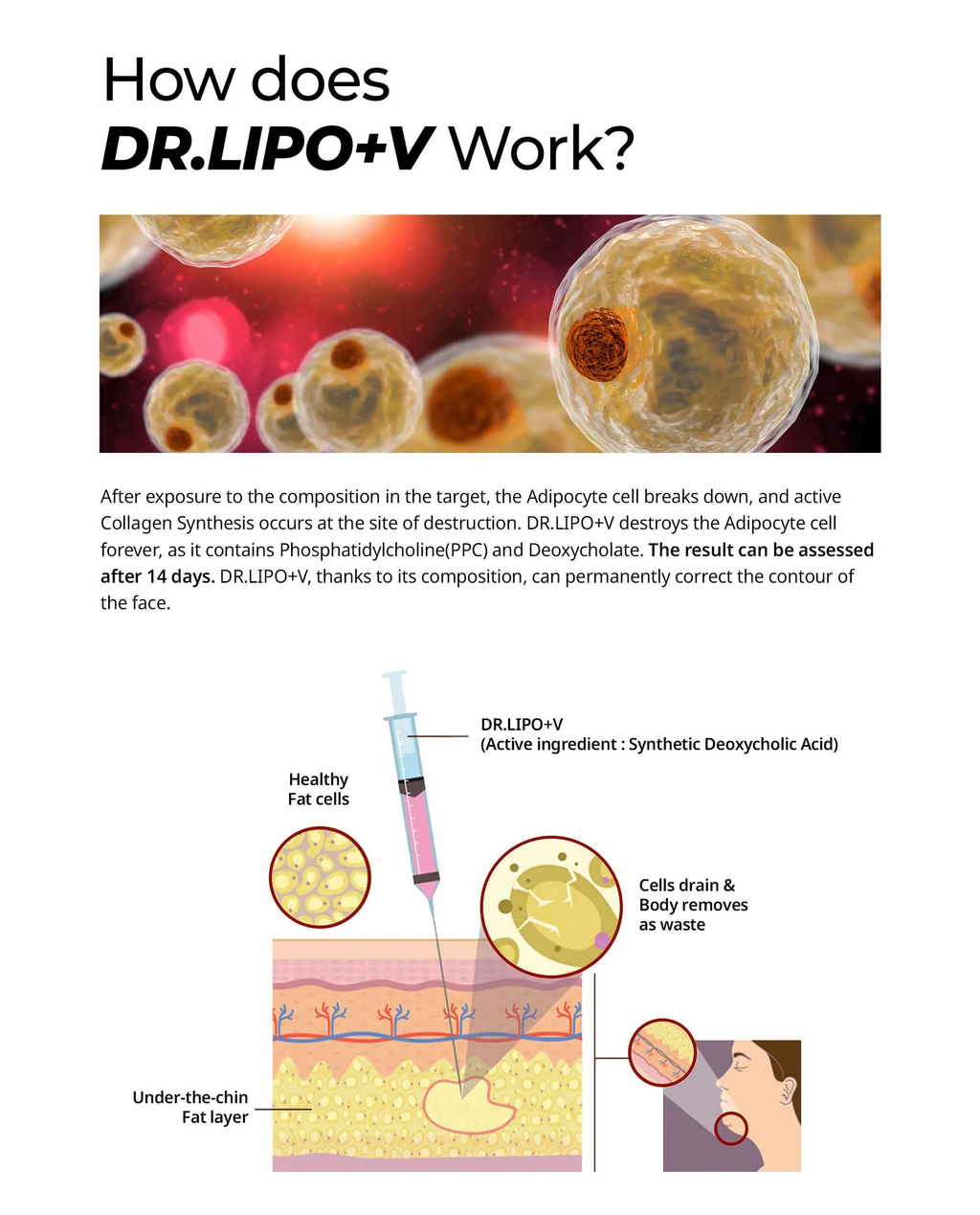 Dr. Lipo (Face) | Jawline & Double Chin Fat Dissolver